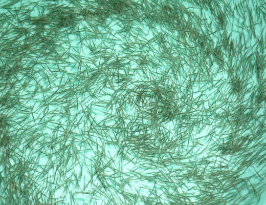 tôm giống tôm thẻ chân trắng Nam Mỹ