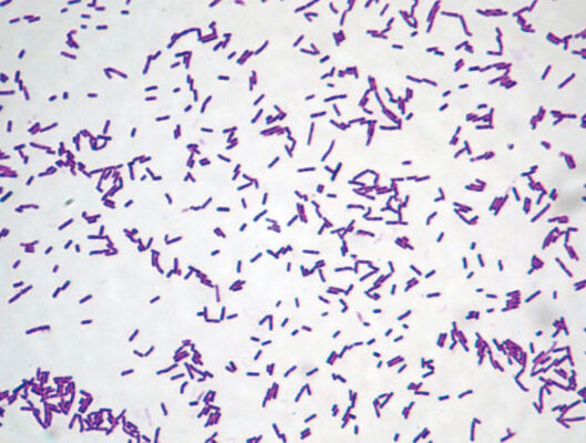 Hệ vi khuẩn trong nuôi tôm