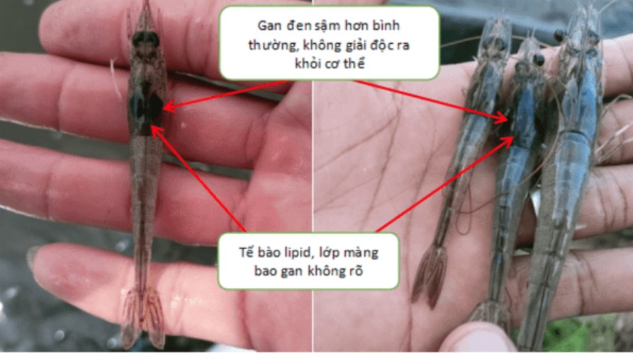 Gan tôm sậm hơn bình thường